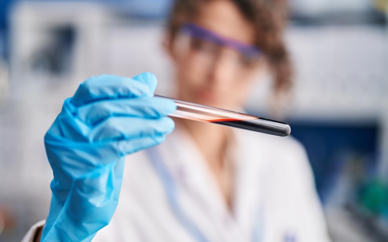 Lab technician with blood sample