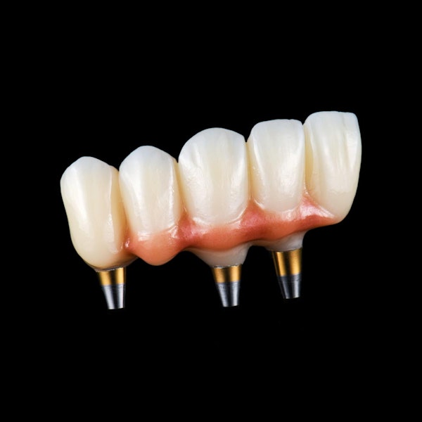 Dental implant bridge