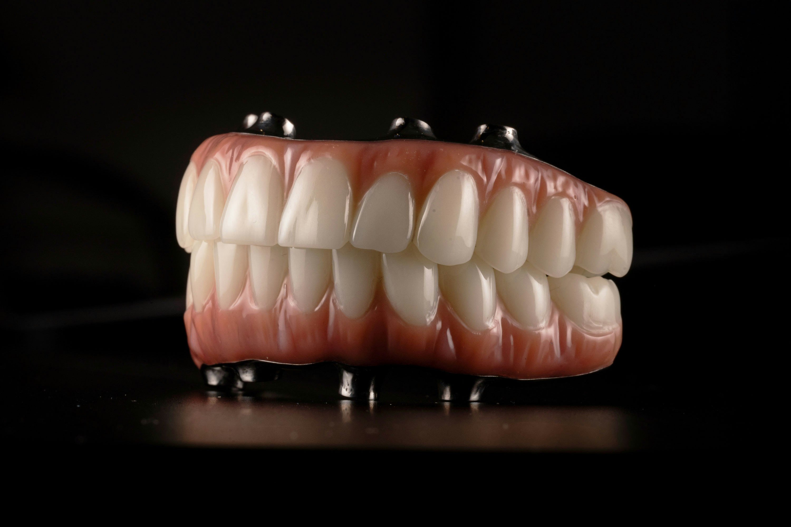 all-on-4 dentures