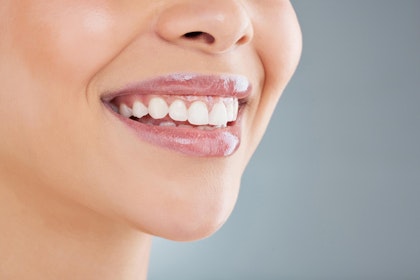 gummy smile treatment