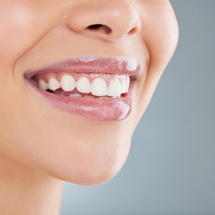 gummy smile treatment