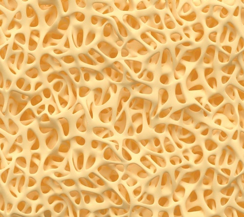 Illustration of microscopic appearance of bone