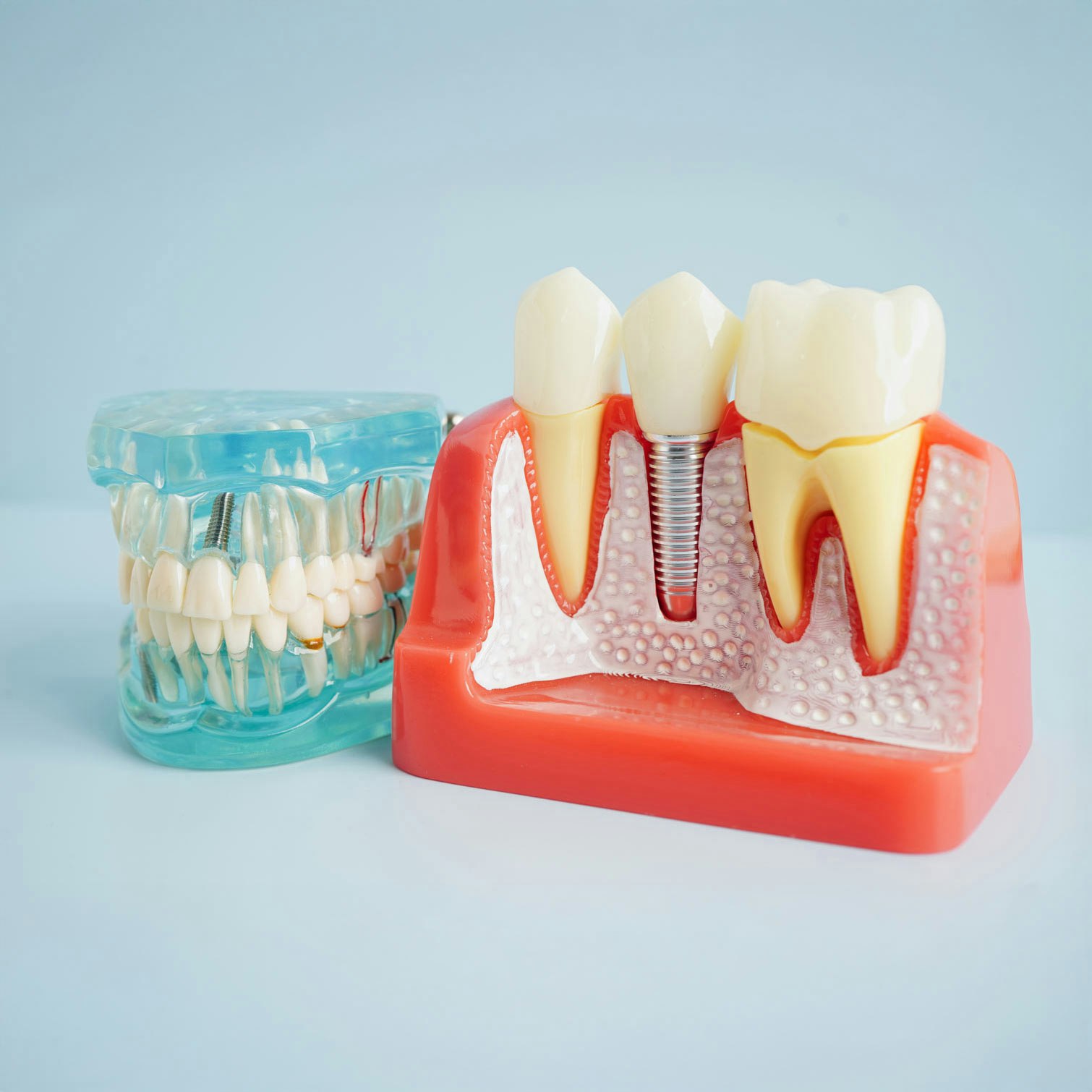 dental implant models