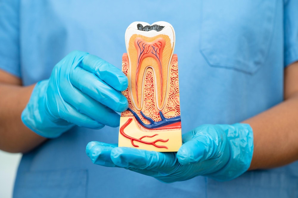 Dentist holding model of infected tooth