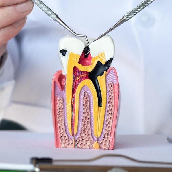 Root canal model