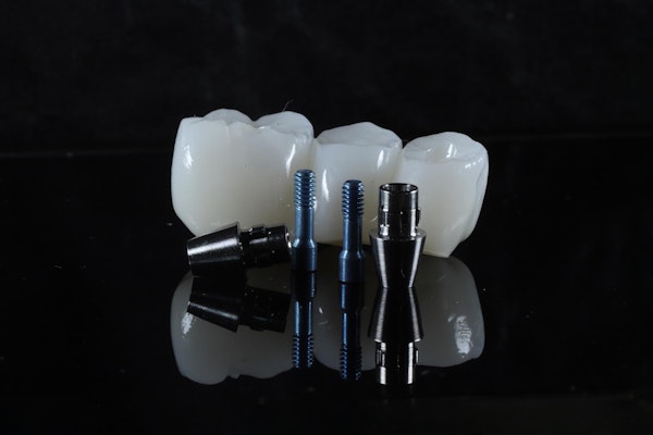 Dental implants in front of a dental bridge