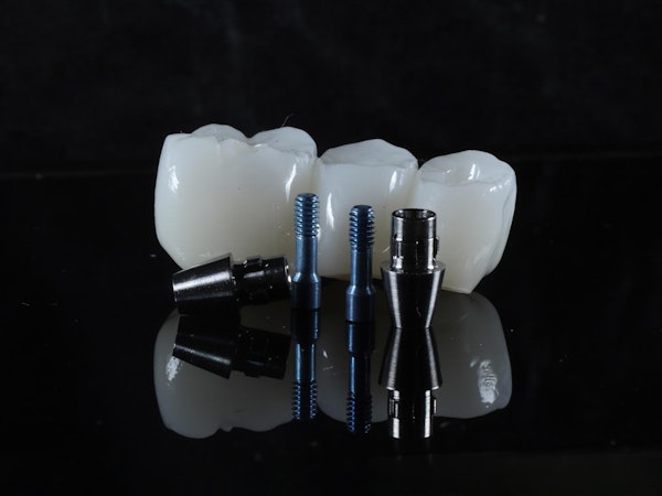 Dental implants in front of a dental bridge