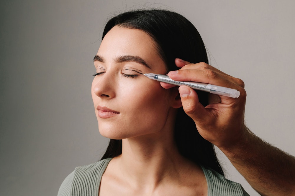 Surgeon drawing eyelid surgery incisions on a woman