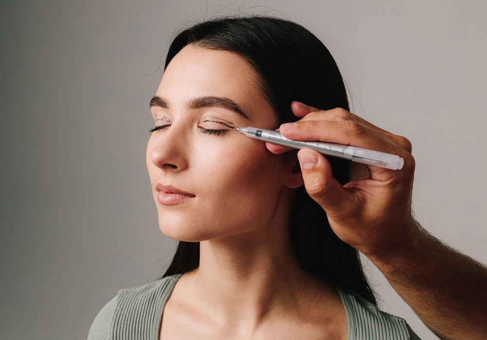 Surgeon drawing eyelid surgery incisions on a woman