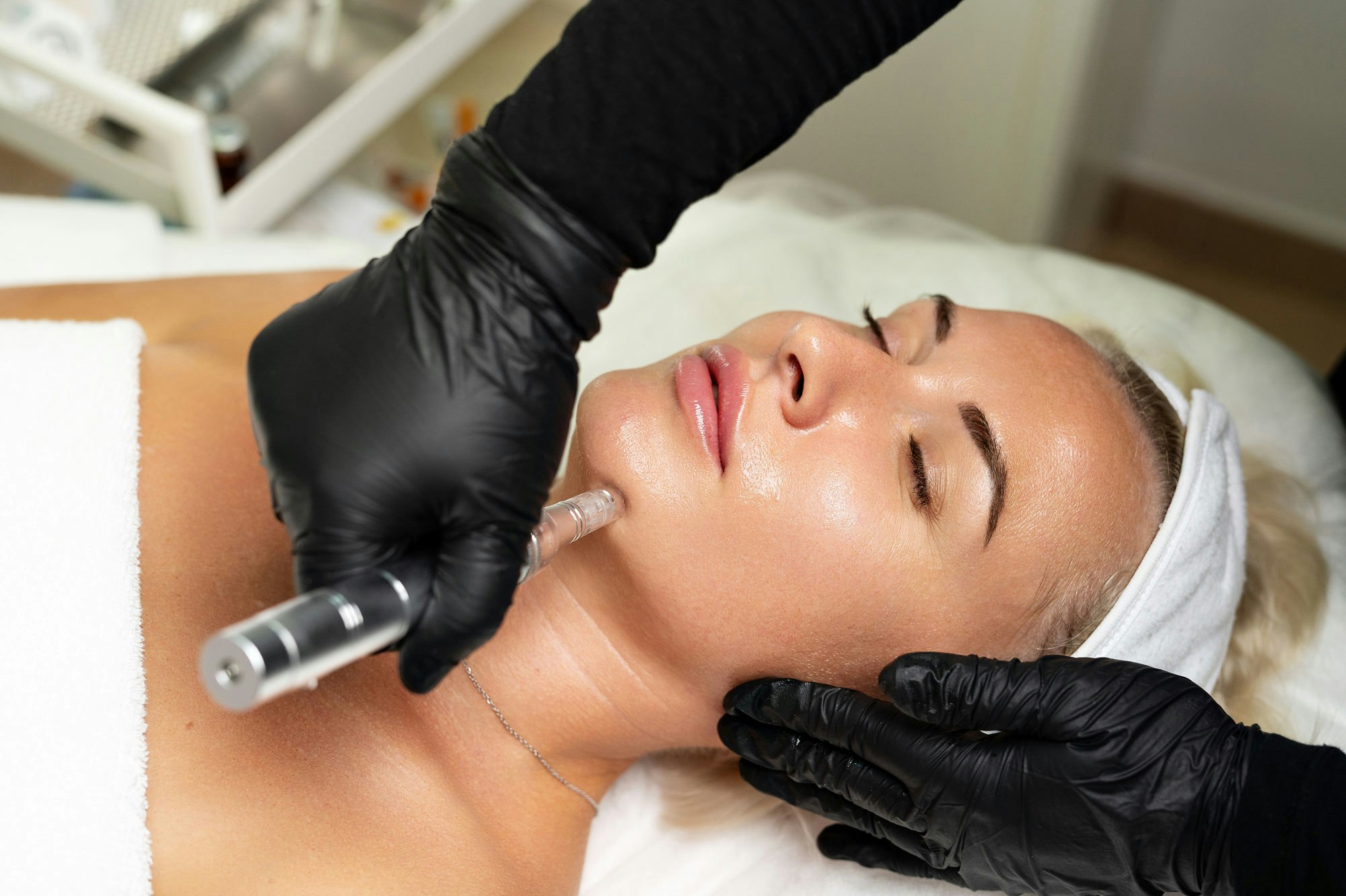woman getting microneedling