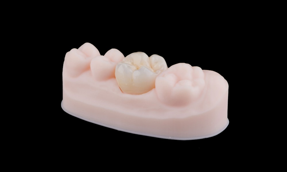 dental crown in silicone model