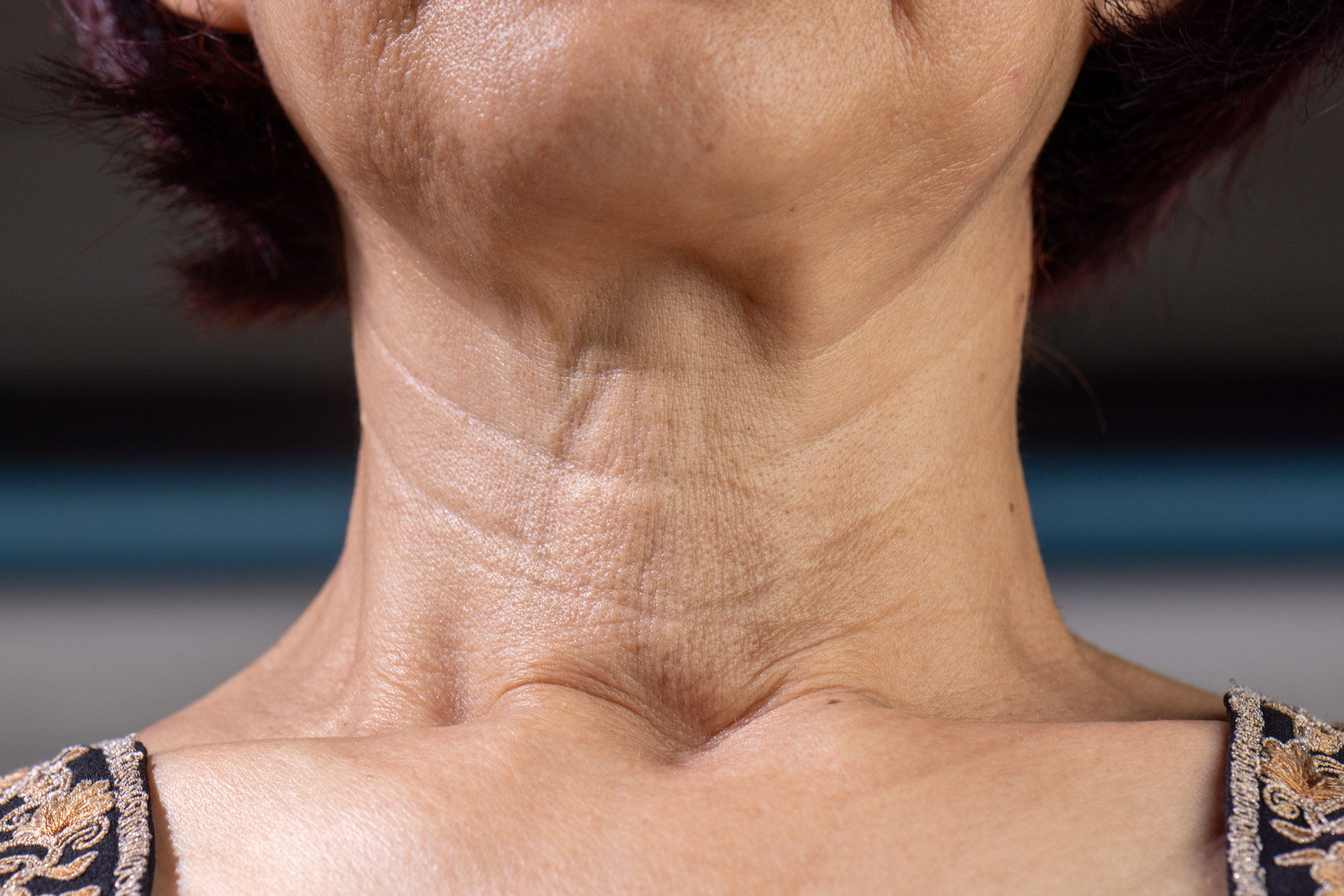 a woman with loose neck and jaw skin