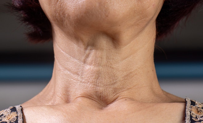 a woman with loose neck and jaw skin