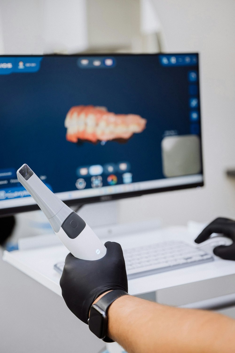 digital scanner and tooth scan in the background