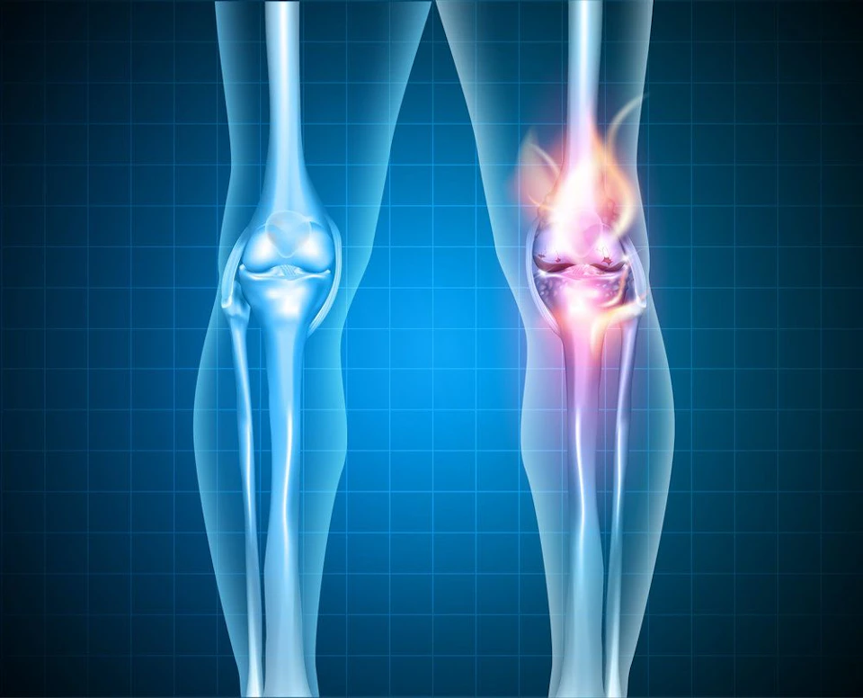 Graphic 3-D highlighting the knee