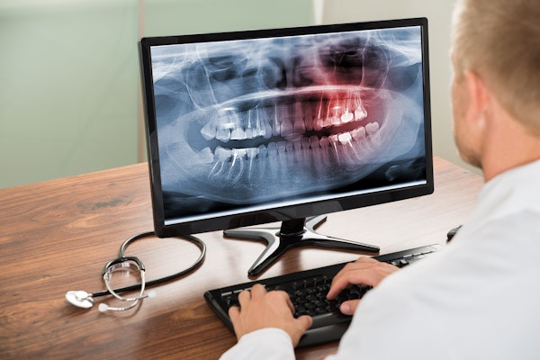 Panoramic digital dental X-ray
