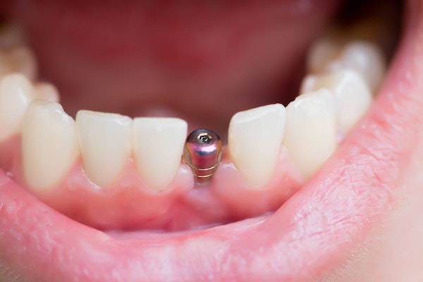 Dental implant