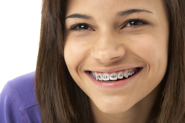 Teen smiling with braces