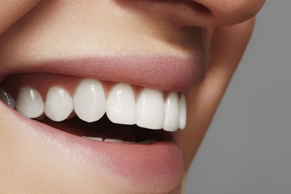 Whitened teeth