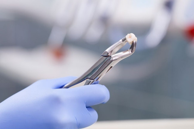 Tooth in forceps