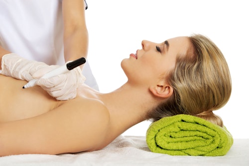 Breast augmentation patient laying on her back with surgeon holding marker