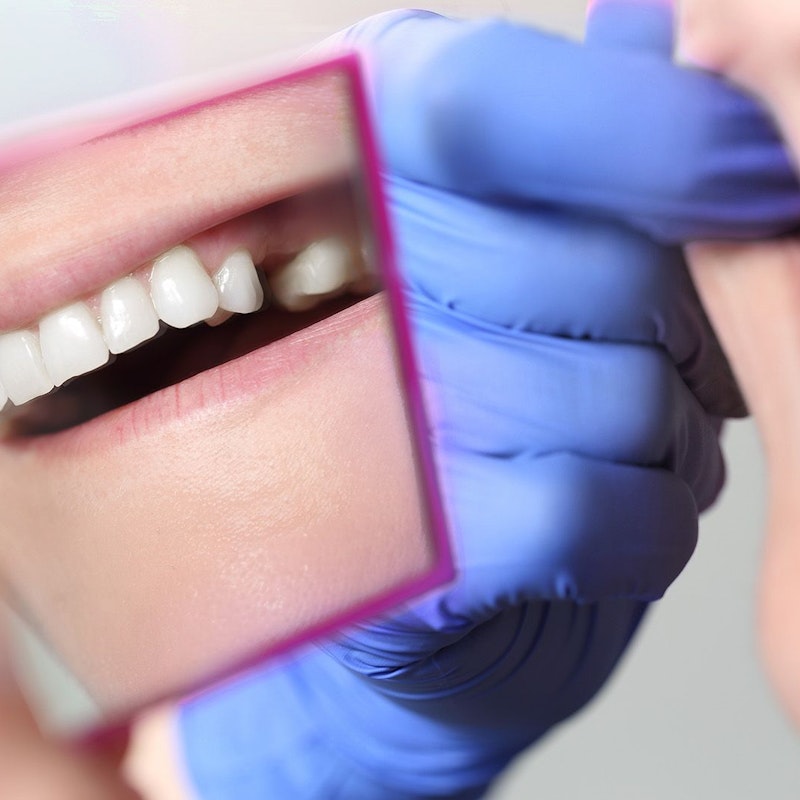 smile missing a single tooth