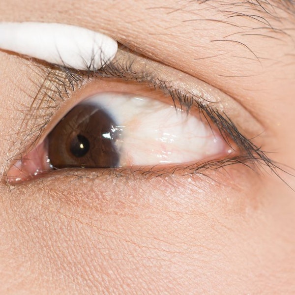 Q tip pulling back eyelid