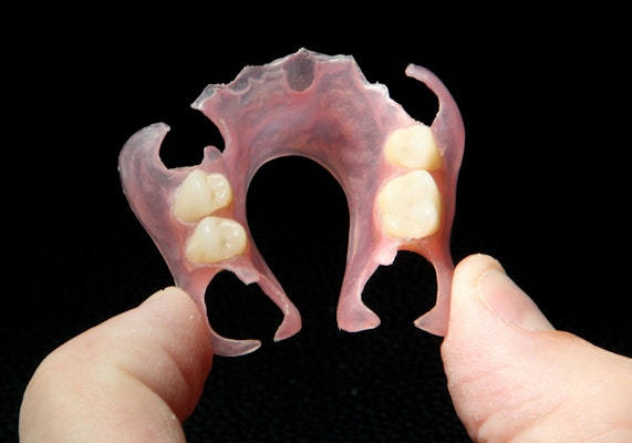 partial denture