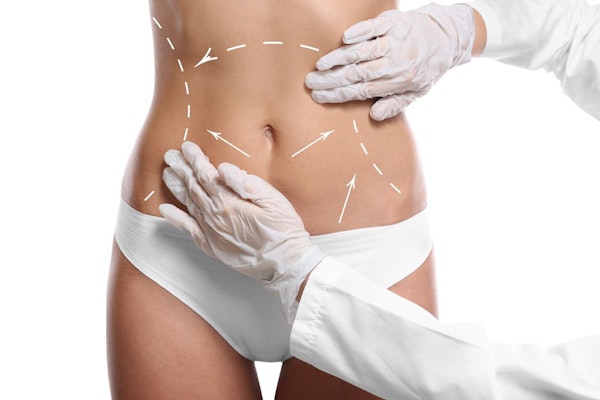 Gloved hands and tummy tuck incisions on woman's midsection