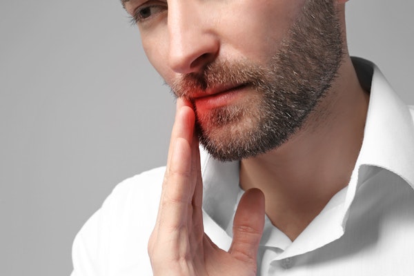 Man touching his jaw