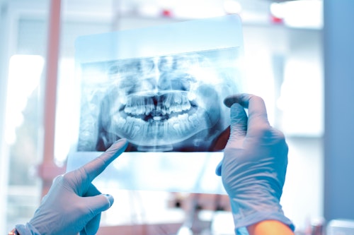 A dentist looking at x-ray images