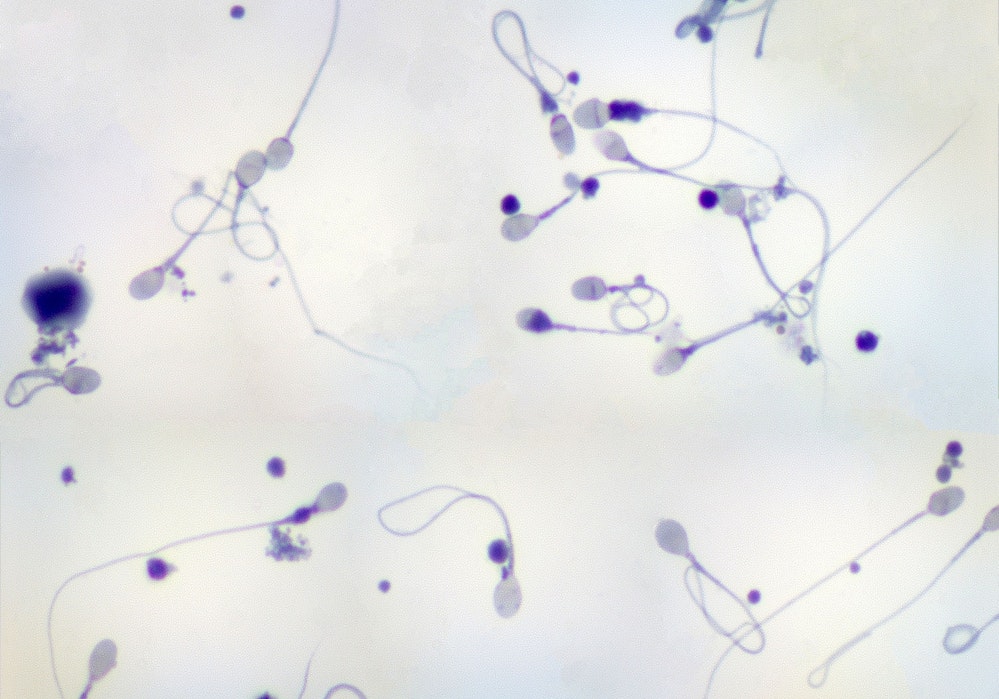 Sperm under a microscope.
