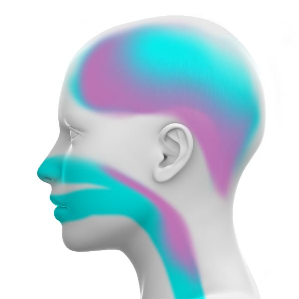Illustration of Complex sleep apnea