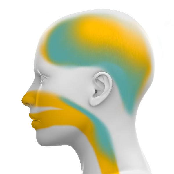 Complex sleep apnea areas of concern