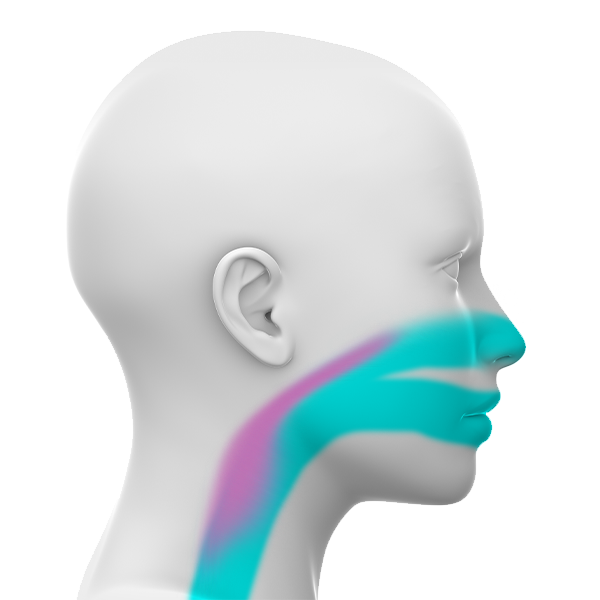 Obstructive sleep apnea model