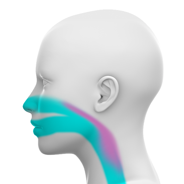 Illustration of obstructive sleep apnea