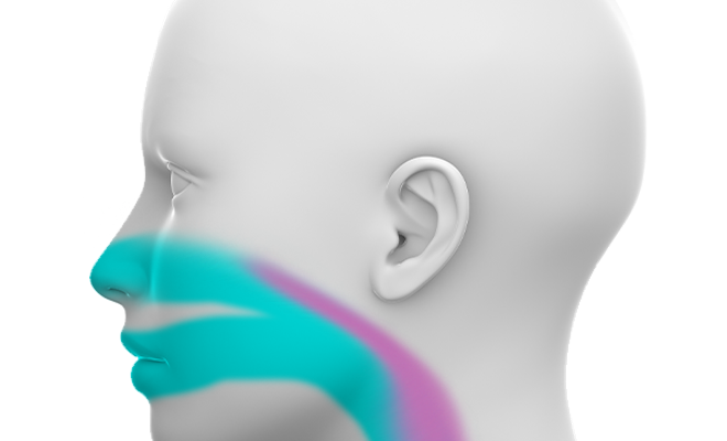 Obstructive Sleep Apnea