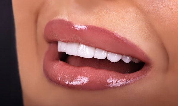 white teeth and glossy lips
