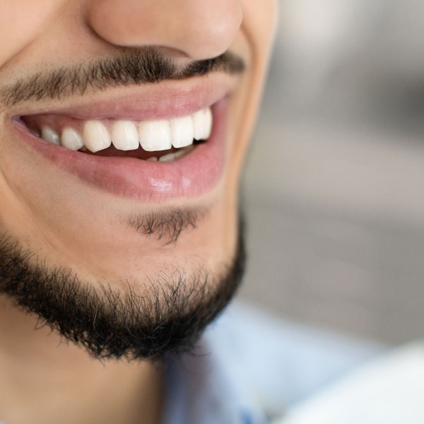 A close up of a man's beautiful white teeth as he is smiling