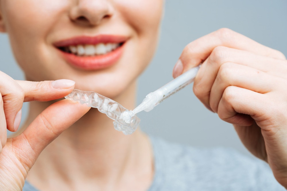 Woman placing teeth whitening agent into a customized tray