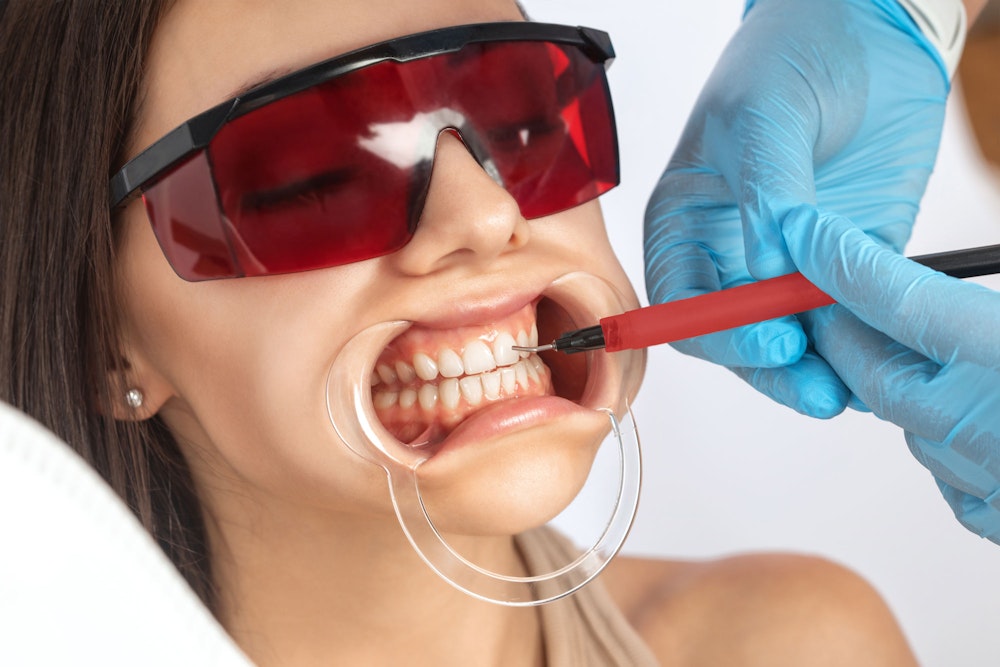 Woman undergoing in-office teeth whitening procedure