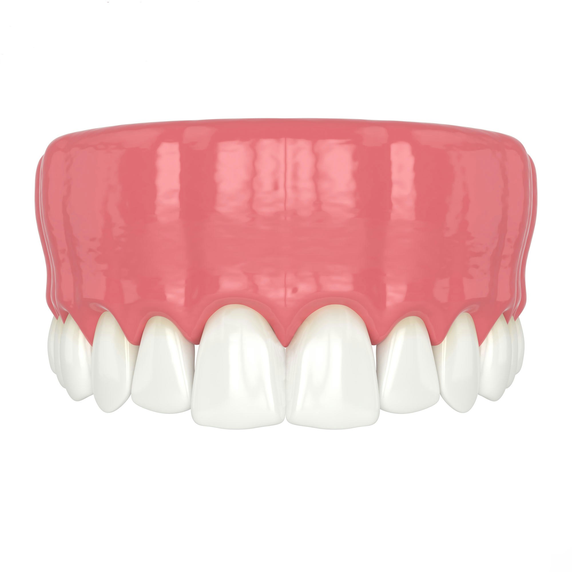 Full Mouth Reconstruction