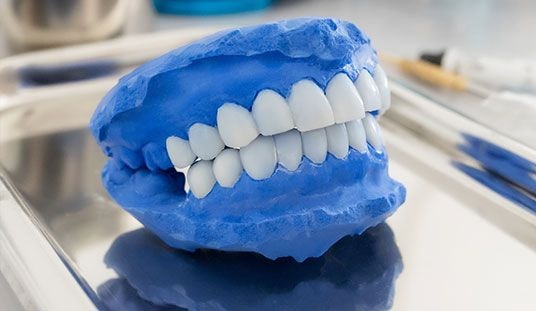 dental wax-up