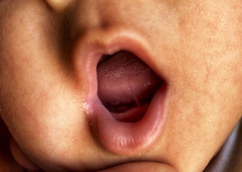 close up of baby with tongue tie