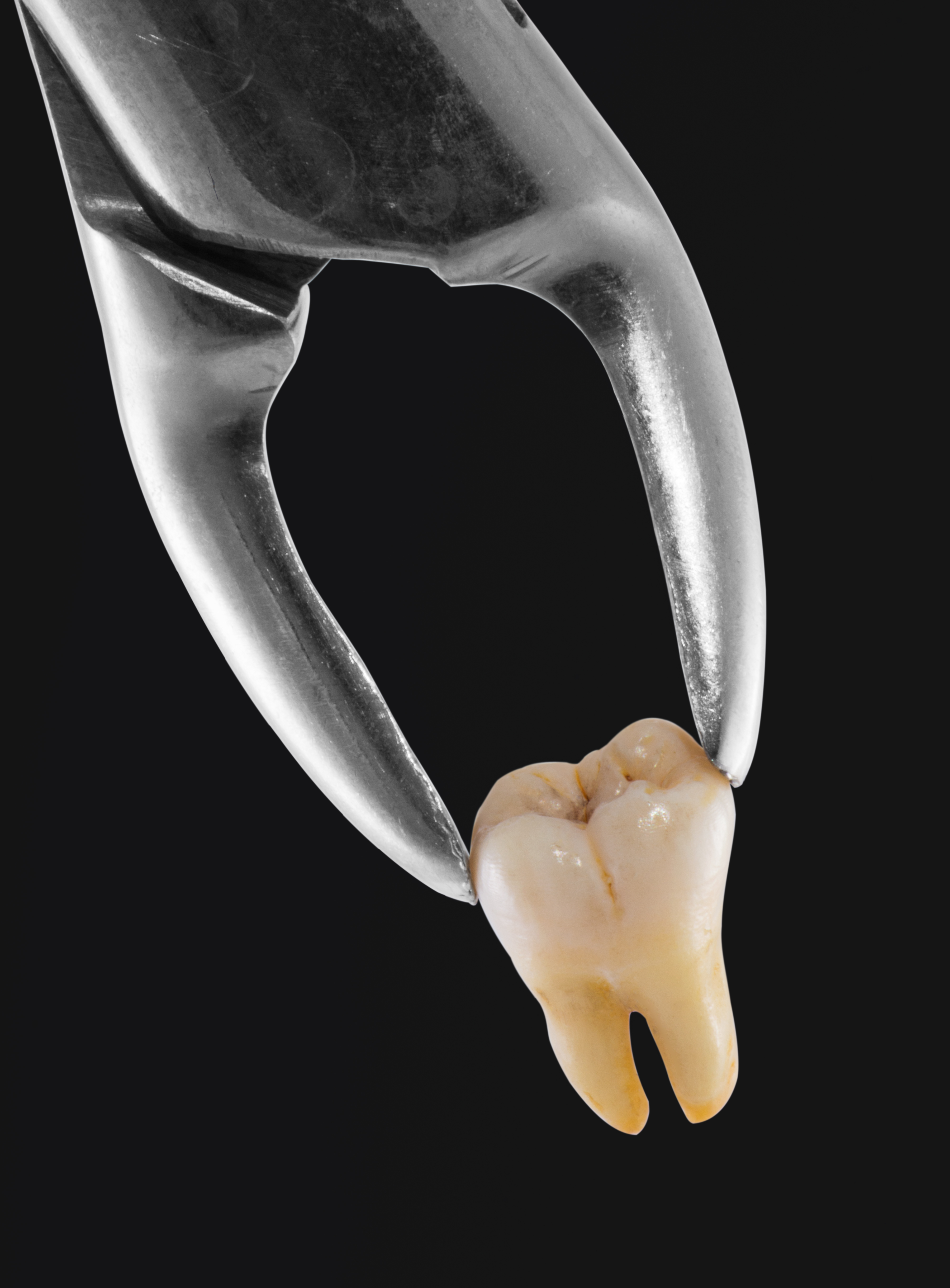 Extracted tooth