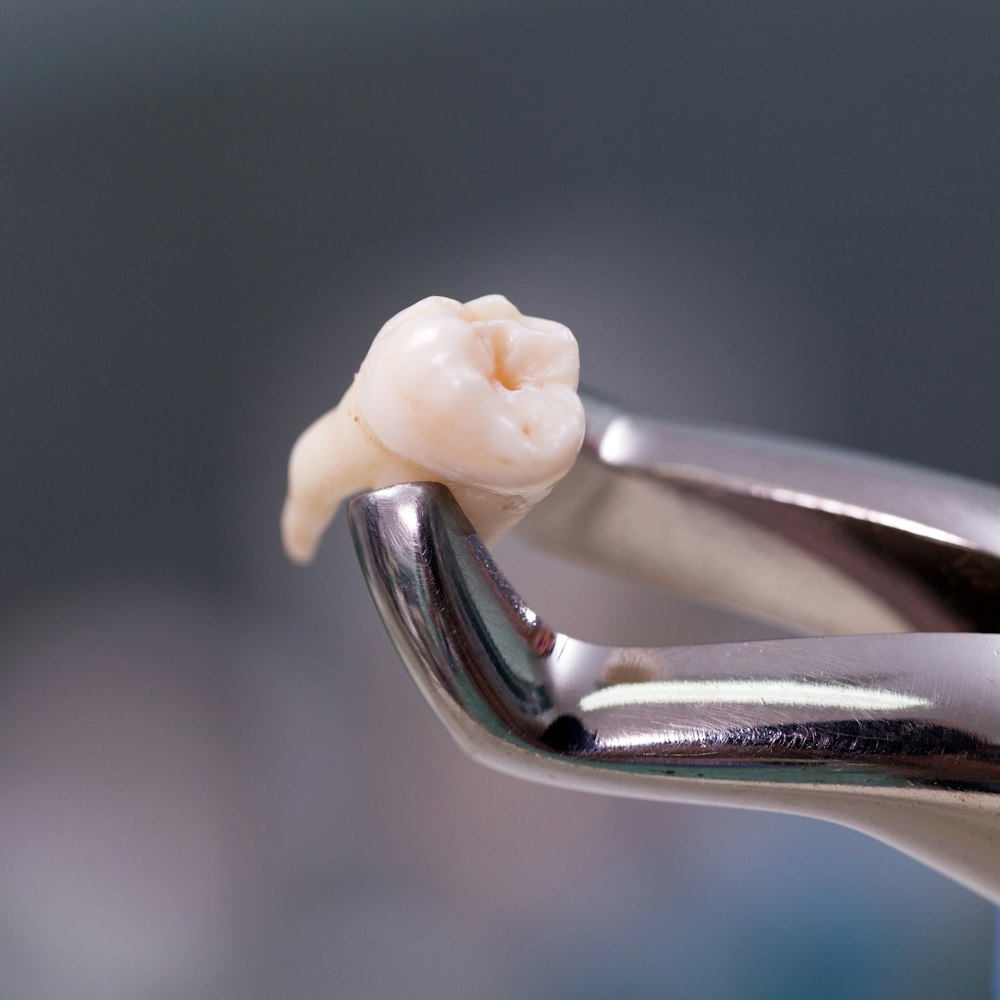 Tooth Extraction