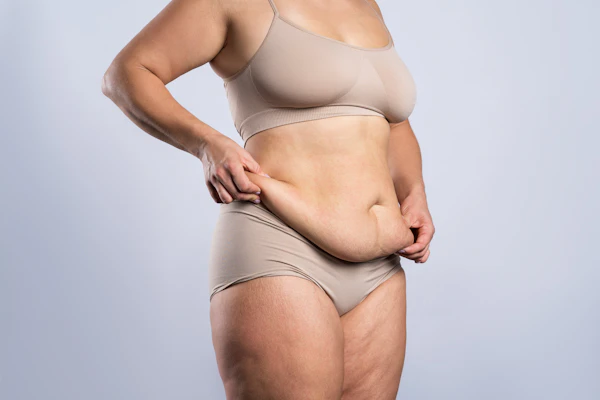 tummy-saggy-skin_1863719626.jpg?w=600&h=600&fit=crop&fit=crop&auto=format