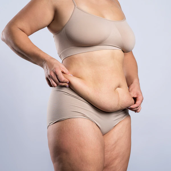tummy-saggy-skin_1863719626.jpg?w=600&h=600&fit=crop&fit=crop&auto=format