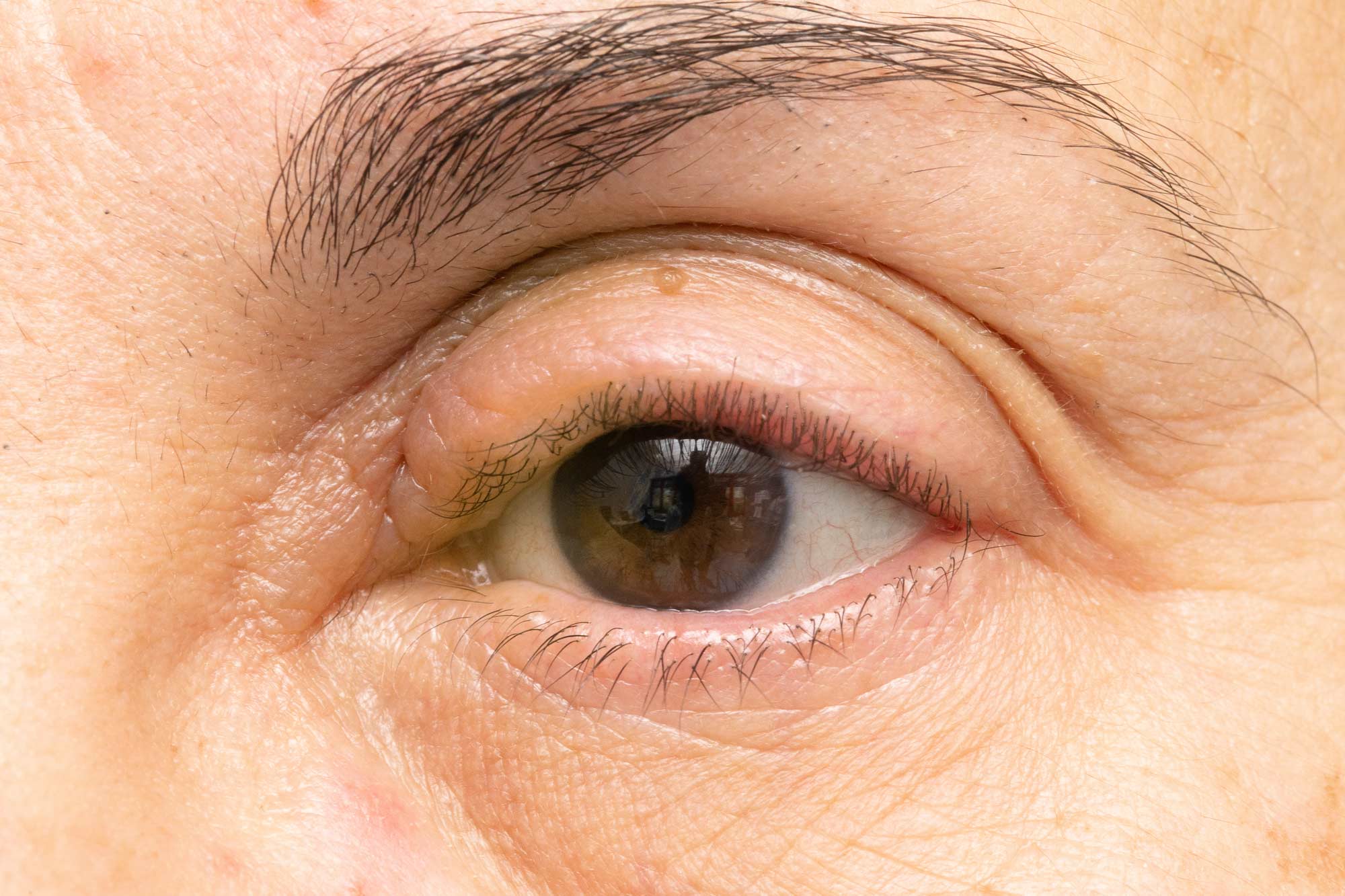 Close-up view of a person’s eye and eyelids