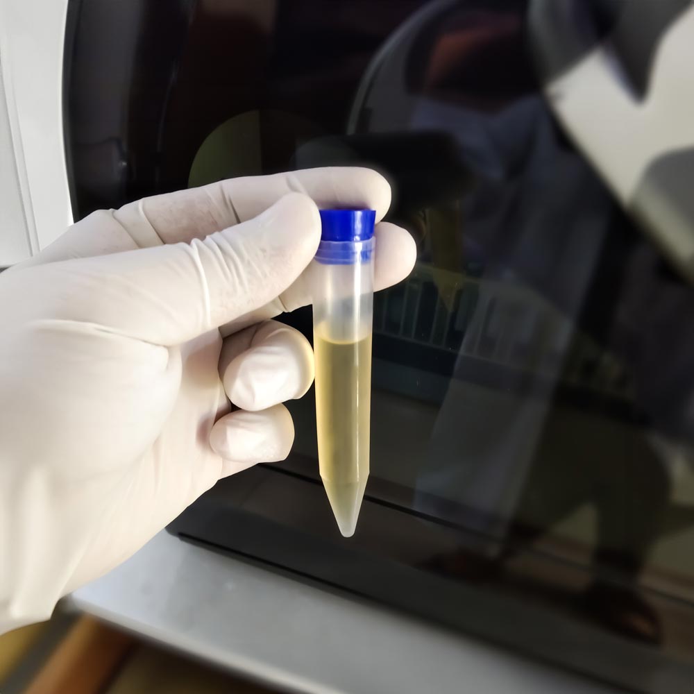 Urine Test being held by hand